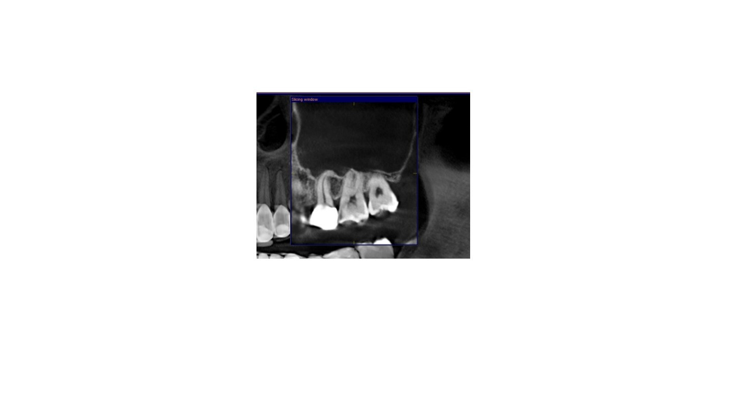 Sinusitis Akibat Infeksi Gigi? Begini Cara Devya Dental Clinic Menangani Kasus Ashanty
            - galeri foto