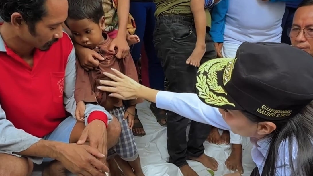 Sherly Tjoanda menduga salah satu anak Suku Togutil mengidap gizi buruk bahkan stunting, karena tubuhnya kurus dan perutnya buncit