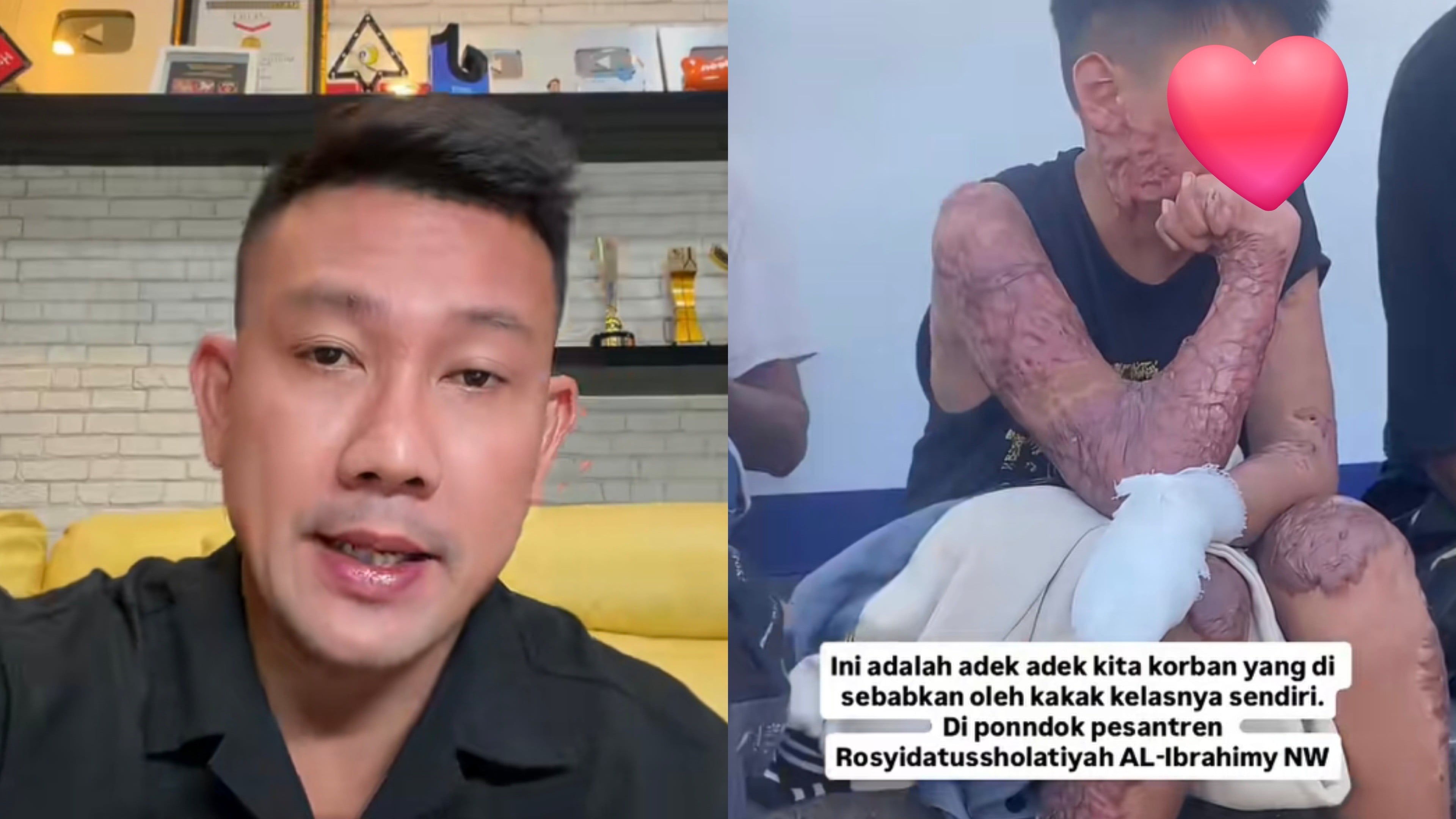 Respons Denny Sumargo soal Korban Kasus Dugaan Pembakaran Santri
