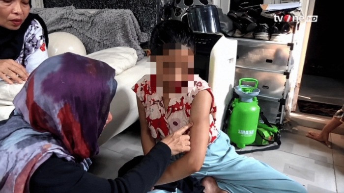 Wanita inisial TS (25), warga Cikarang Utara luka lebam diduga akibat menjadi korban penyekapan dan penganiayaan oleh pacar, SL (28) di Cikarang Selatan, Kabupaten Bekasi