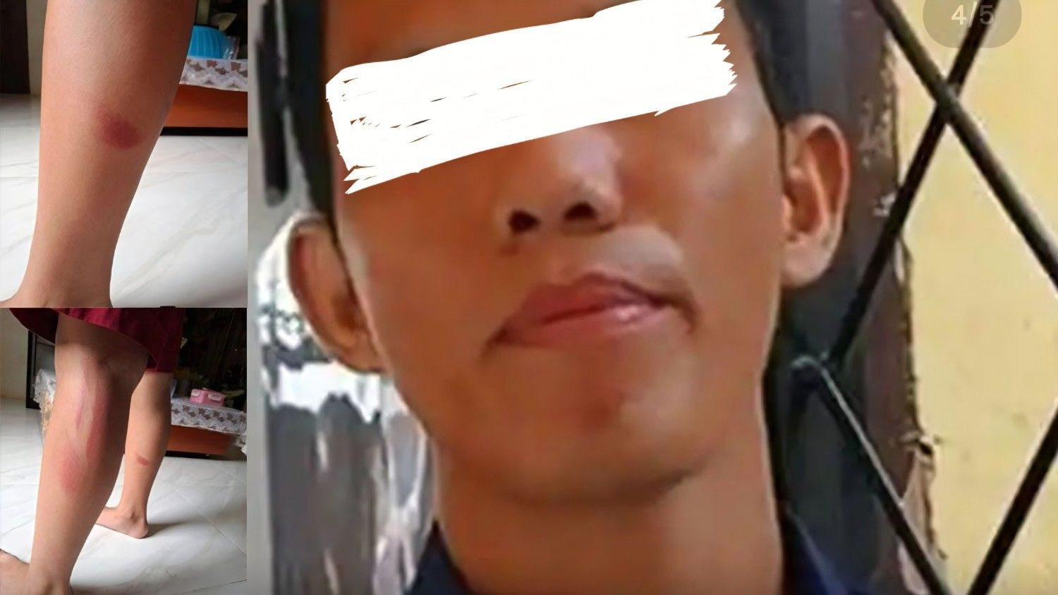 Viral Guru Dilaporkan ke Polisi karena Diduga Pukul Murid pakai Penggaris