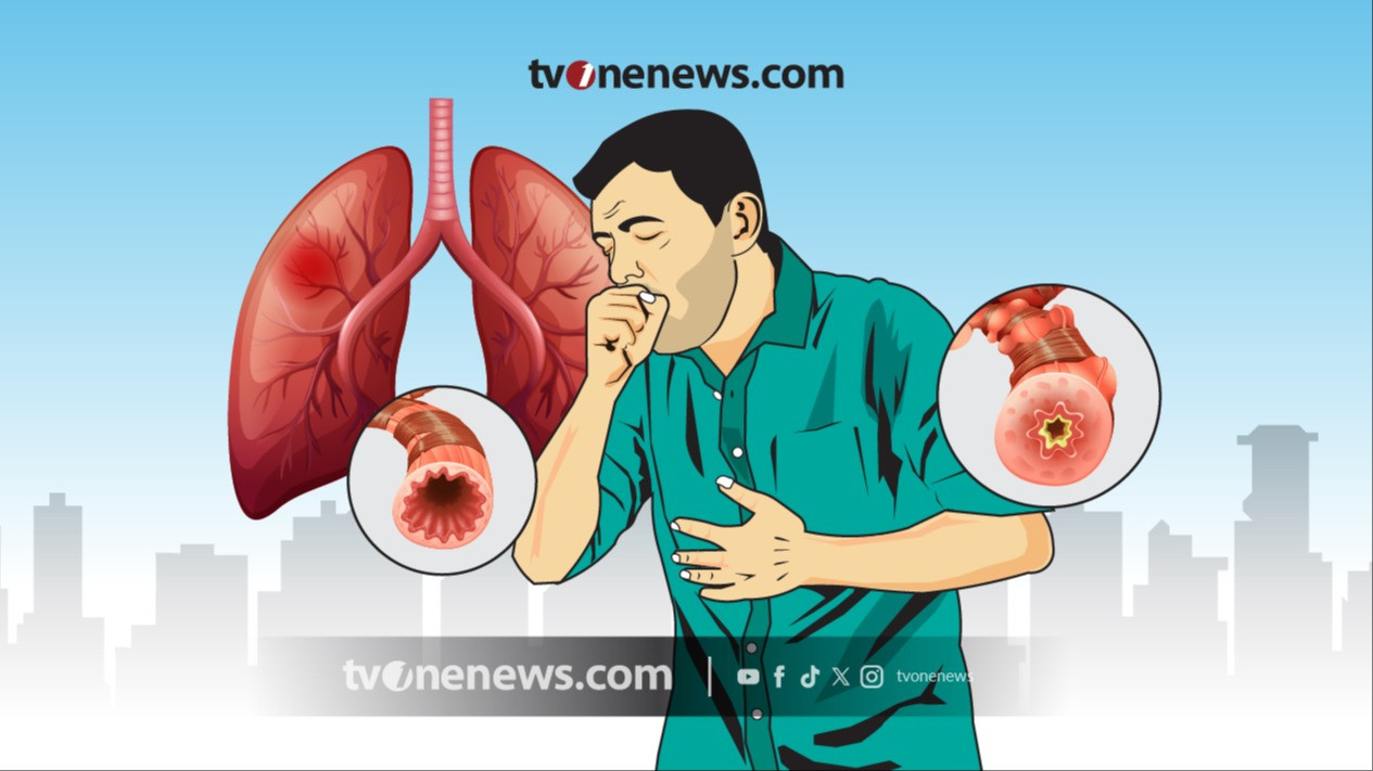 Ilustrasi Sakit Pneumonia