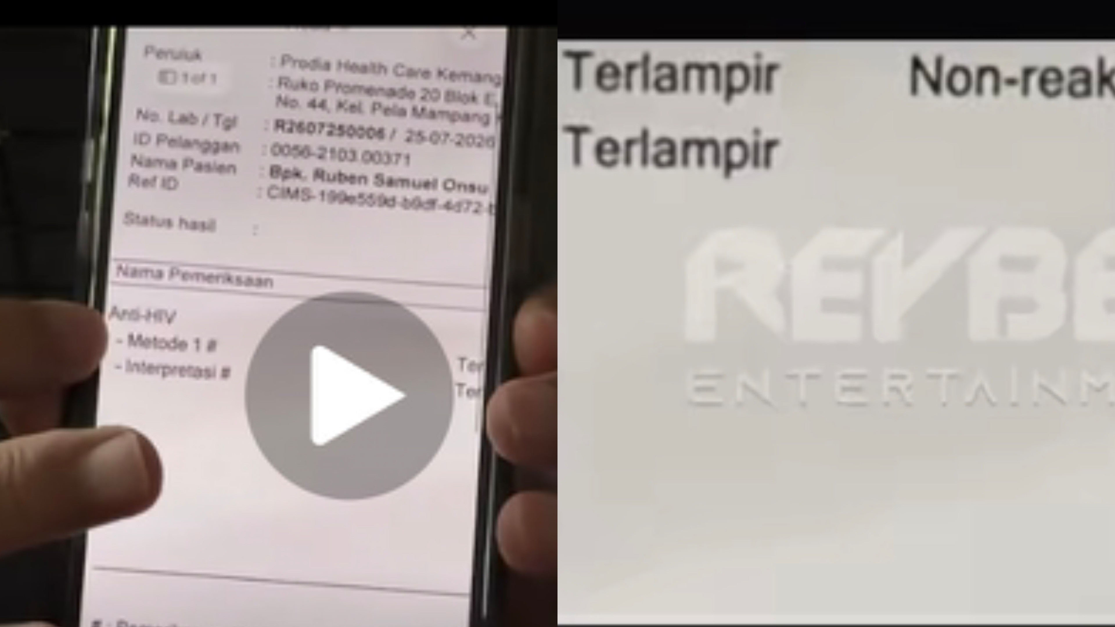 Hasil Tes Kesehatan Ruben Onsu