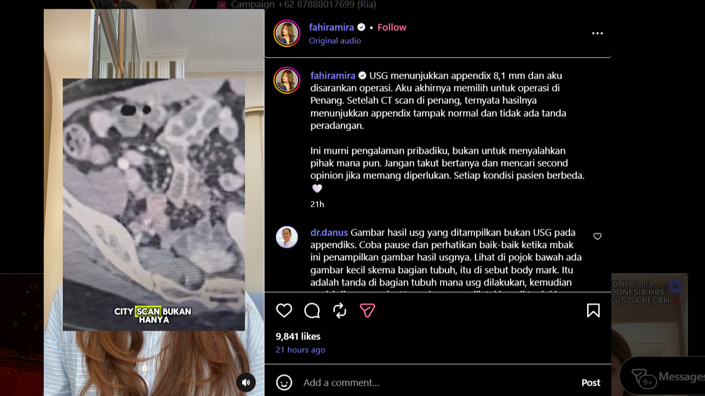 Kronologi Fahira Mira Viral Usai Klaim Divonis Usus Buntu di 3 RS Indonesia, Berobat ke Penang Malah Beda Diagnosis
            - galeri foto