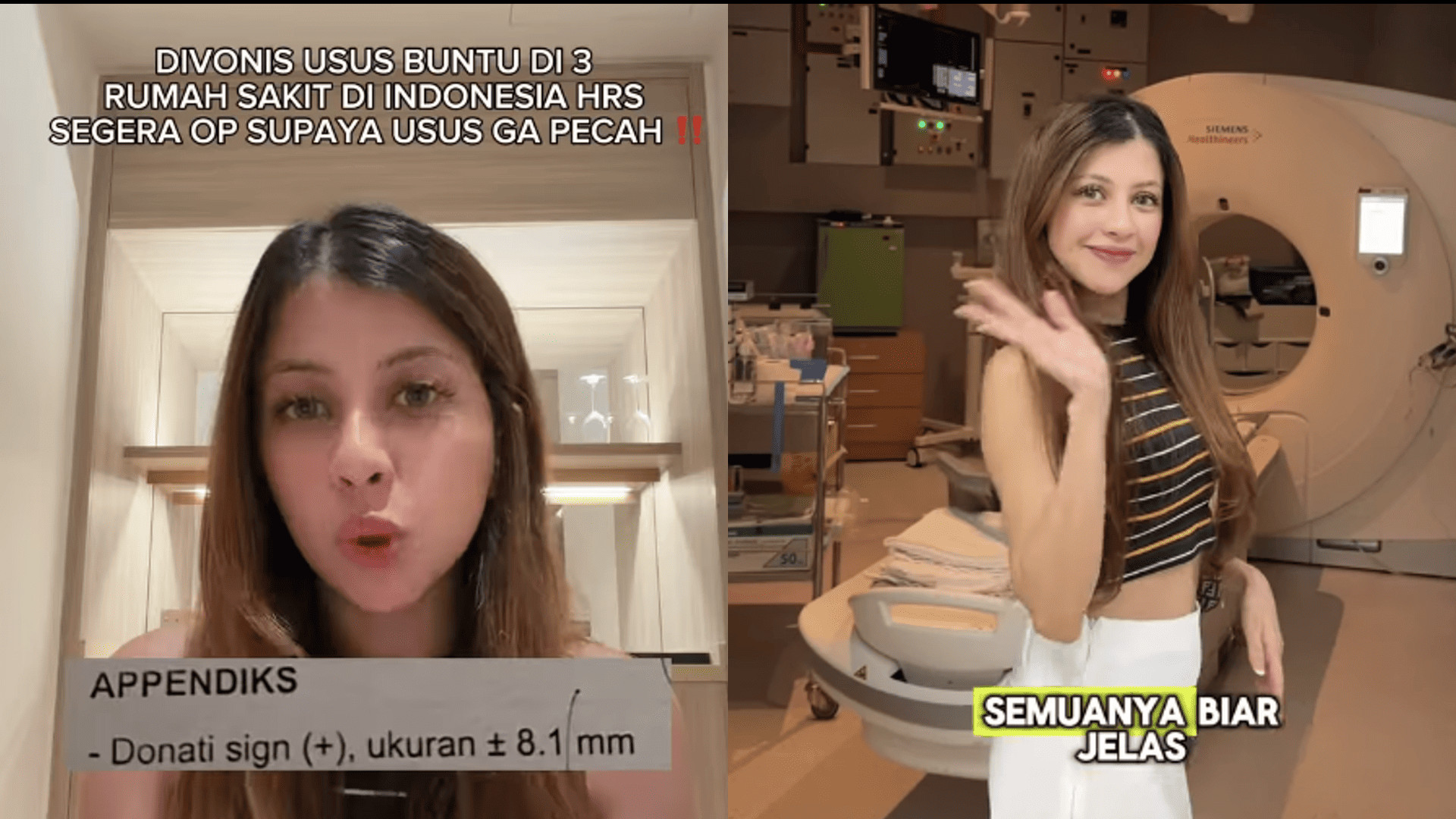 Selebgram Fahira Almira Ungkap Perbedaan Diagnosis Usus Buntu di Indonesia dan Malaysia