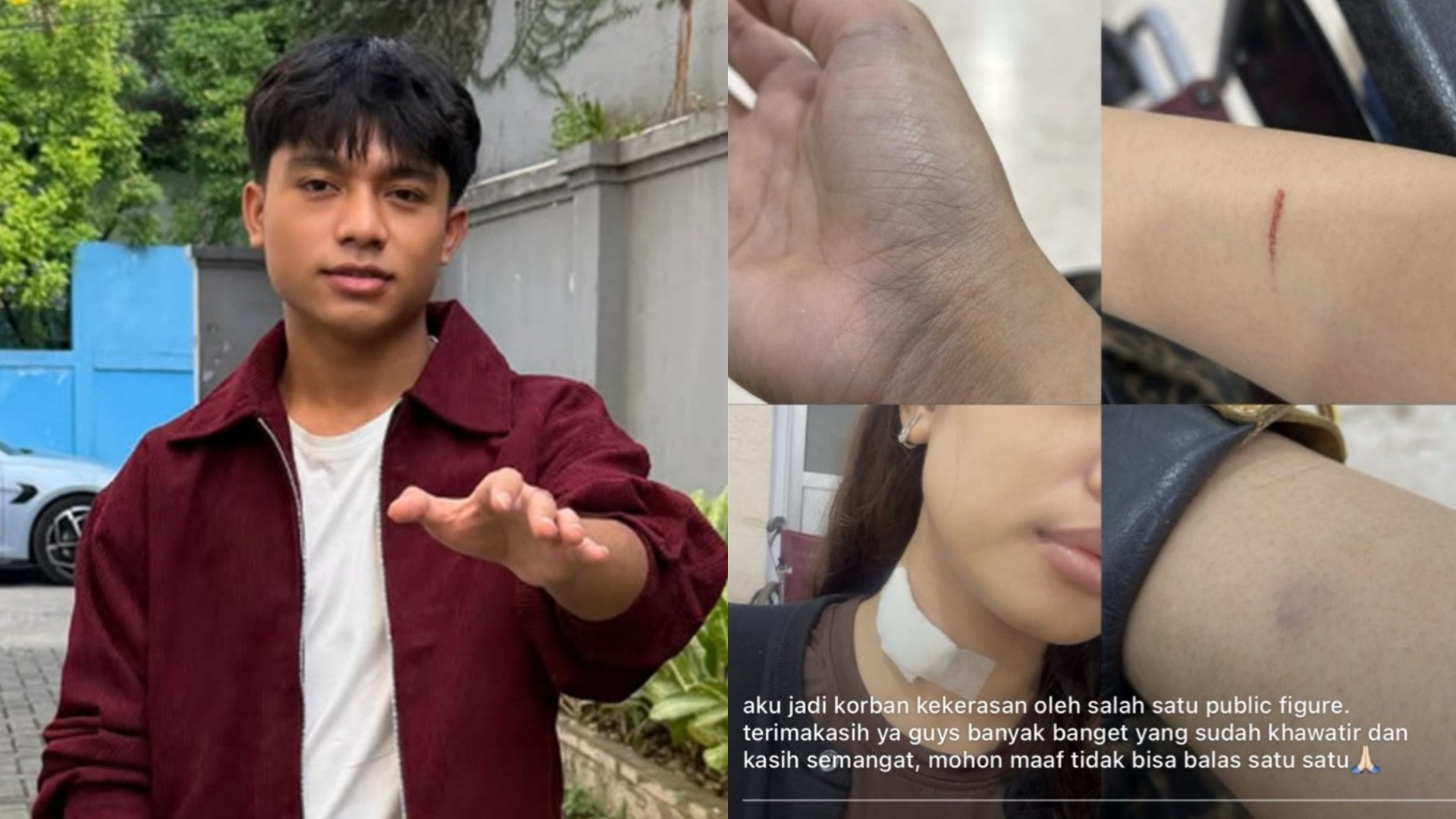 Betrand Peto | Kondisi korban Betrand Peto yang luka-luka diduga karena mendapat kekerasan seksual