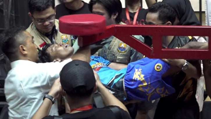 Komedian Dede Sunandar kolaps usai ditinju Vicky Prasetyo