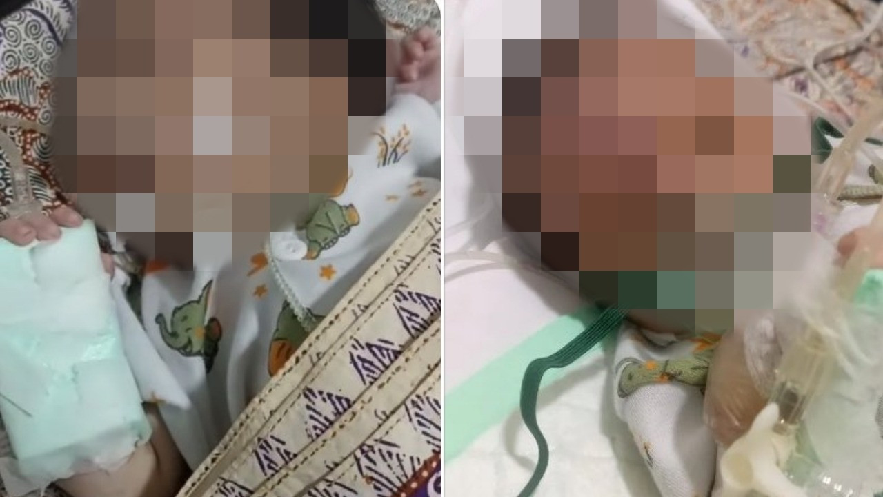 Bayi 24 hari di Surabaya meninggal dunia usai dicekoki telur mentah oleh neneknya.