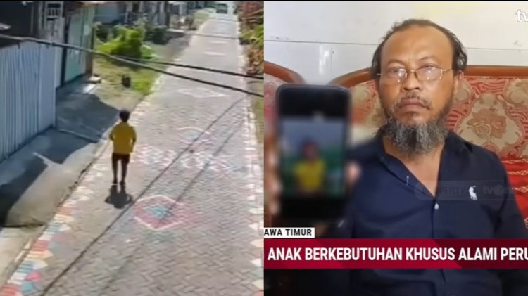 Anak down syndrome di Surabaya tewas usai dibully dua bocah tetangga