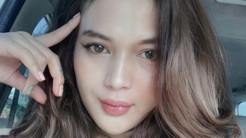 6 Artis Indonesia Ini Dulu Pria tapi Operasi Kelamin Jadi Wanita, Ada