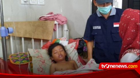 Pamekasan Measles Outbreak, 109 Children Exposed