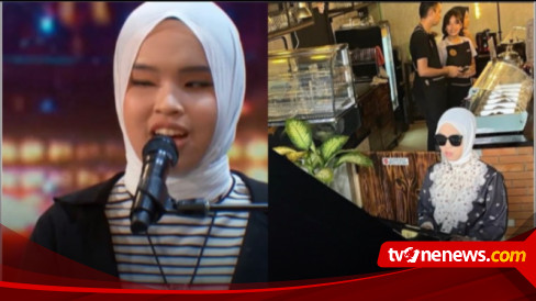 Sempat Punya Mata Normal, Putri Ariani Kini Ikhlas Berdamai dengan Masa Lalu: Ada Kesalahan Rumah Sakit, Dulu Paru-Paruku…