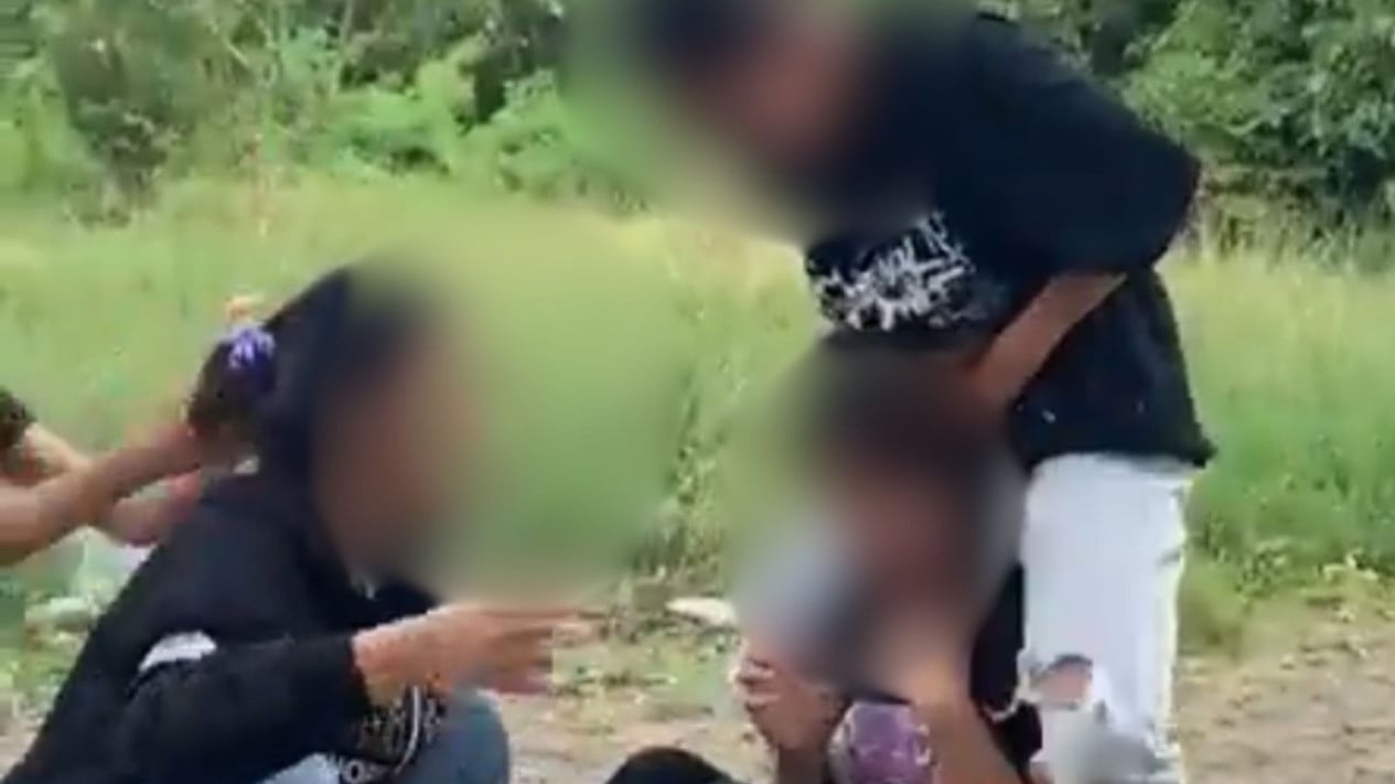 Wajah Siswi SMP Disundut Rokok oleh Teman-temannya, Polisi Gerak Cepat Kantongi Nama-nama Pelaku Bullying
            - galeri foto