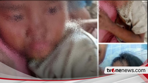 Viral, Kronologi Ibu Angkat Aniaya Bocah 7 Tahun, Pelaku Sempat Lakukan Ini ke Tubuh Korbannya